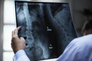 Medico olhando radiografia, como descartar chapa de raio-x